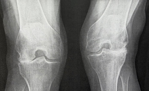 Before X-ray